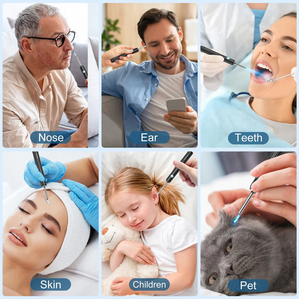 Stravax™ Ear wax Remover Kit